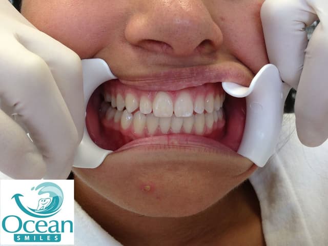 Ocean Smiles photo