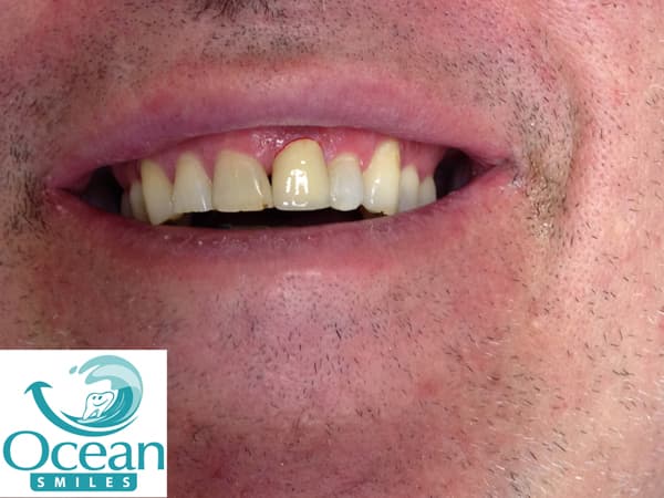 Ocean Smiles photo