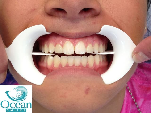Ocean Smiles photo