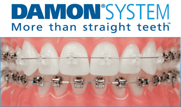 Smile Orthodontics photo