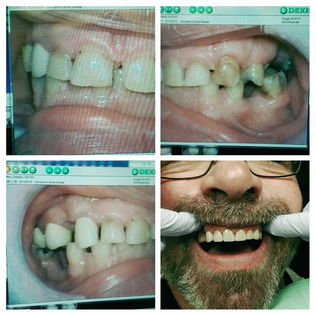 A Mile of Smiles photo