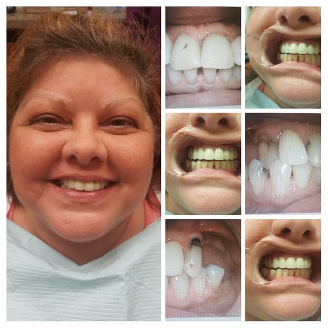 A Mile of Smiles photo