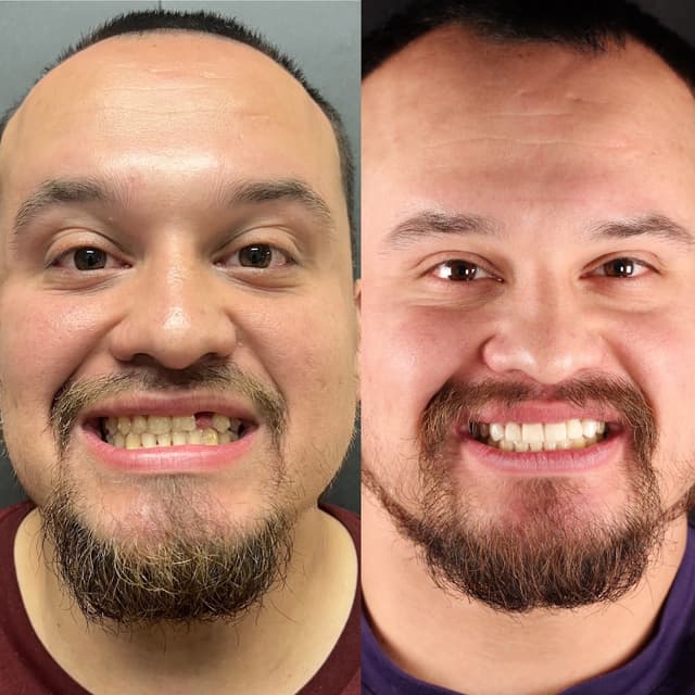 Smile Square photo