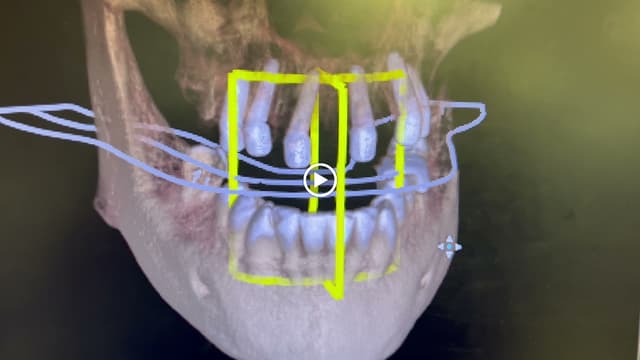 Smile Square photo