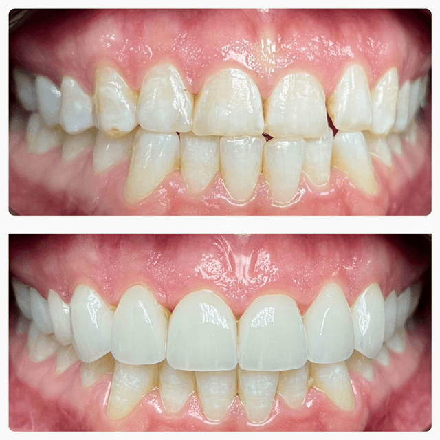 Smile Square photo