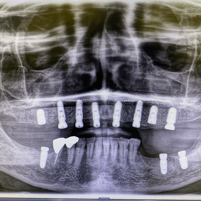 Smile Square photo