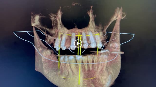 Smile Square photo