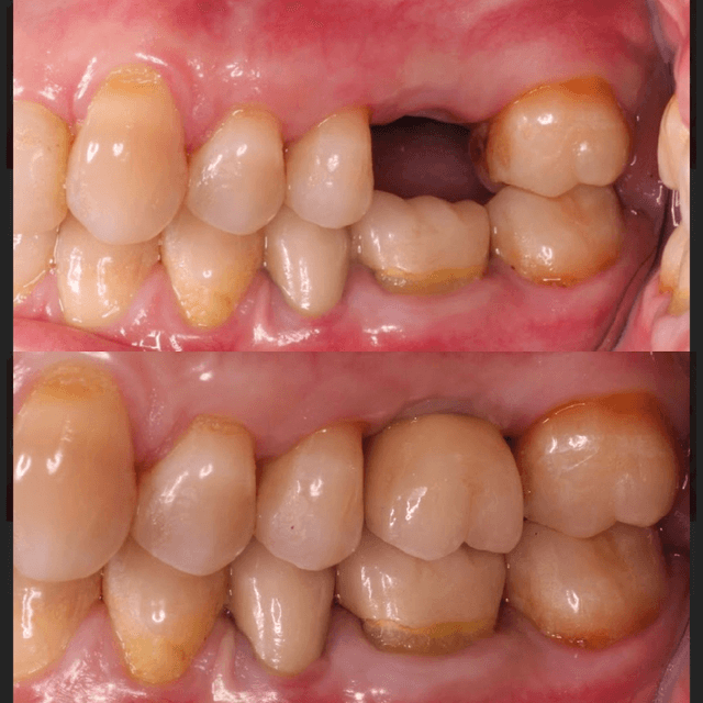 Smile Square photo