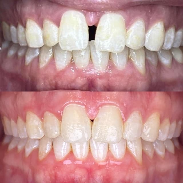 Smile Square photo