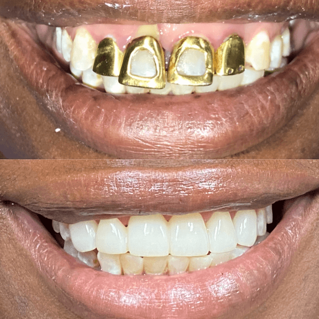 Smile Square photo