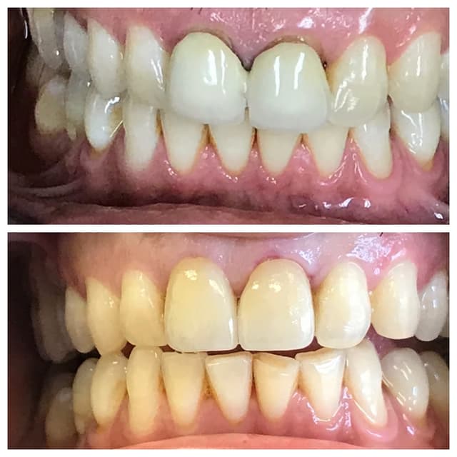 Smile Square photo