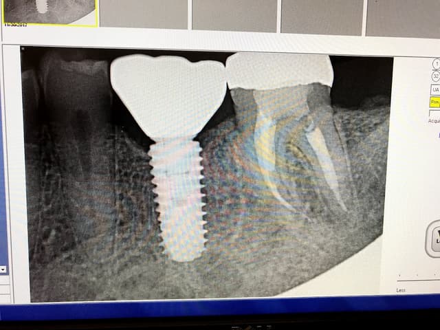 Smile Square photo