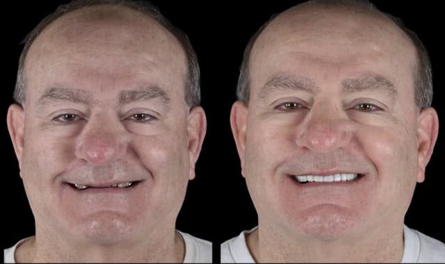 Smile Square photo