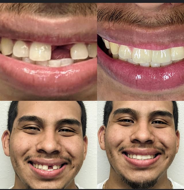 Smile Square photo