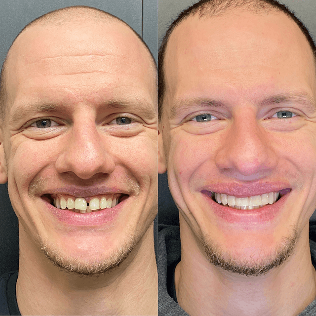 Smile Square photo