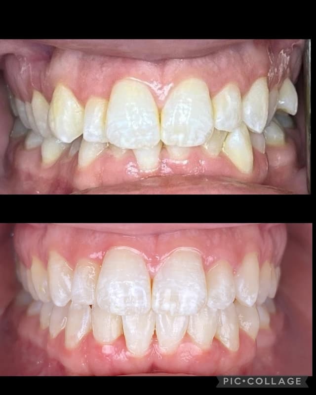 Smile Square photo