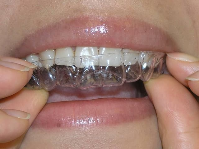 Cooper Orthodontics - Previously Henson Orthodontics photo