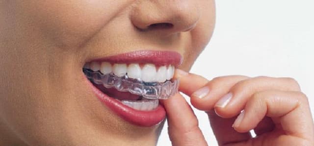 Cooper Orthodontics - Previously Henson Orthodontics photo