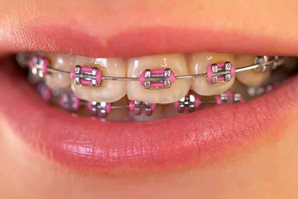 Cooper Orthodontics - Previously Henson Orthodontics photo