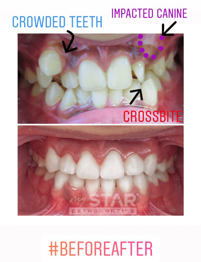 My Star Orthodontics photo