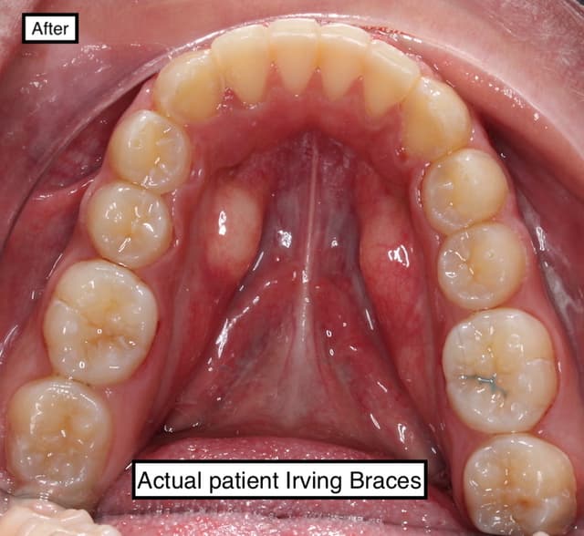 Irving Orthodontics photo