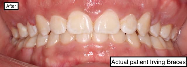 Irving Orthodontics photo