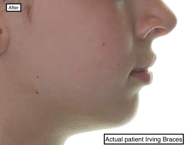 Irving Orthodontics photo