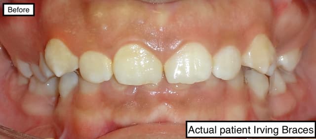 Irving Orthodontics photo