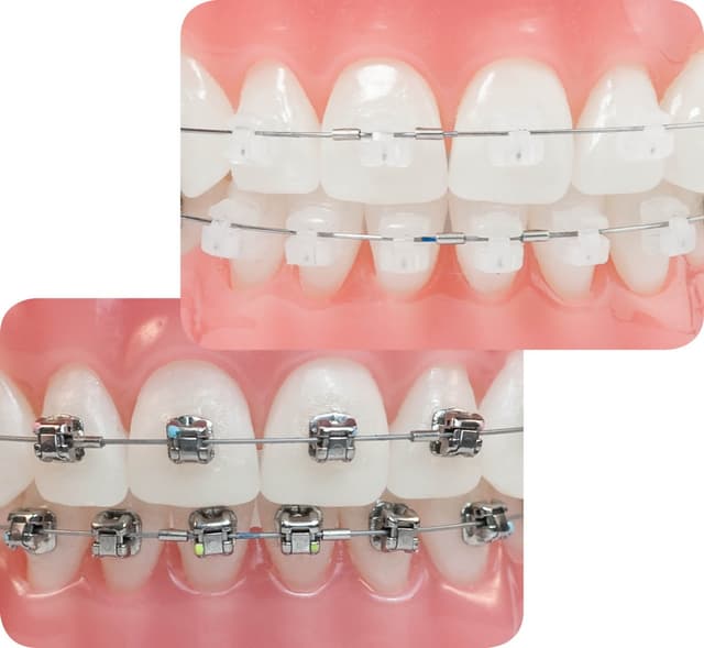 Irving Orthodontics photo