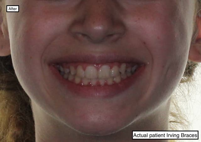 Irving Orthodontics photo