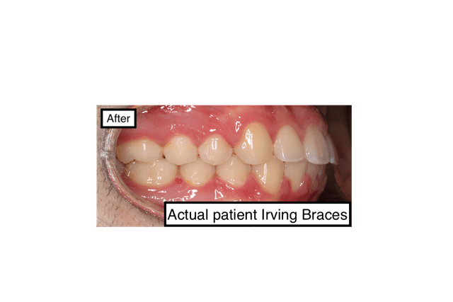 Irving Orthodontics photo