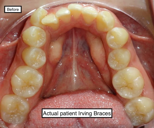 Irving Orthodontics photo