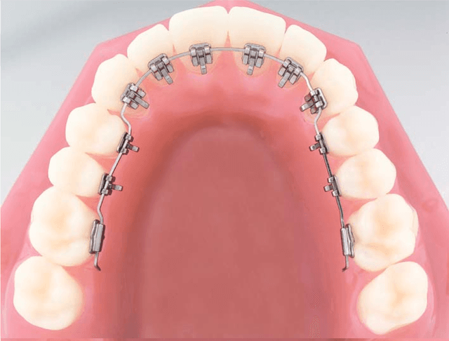 Irving Orthodontics photo