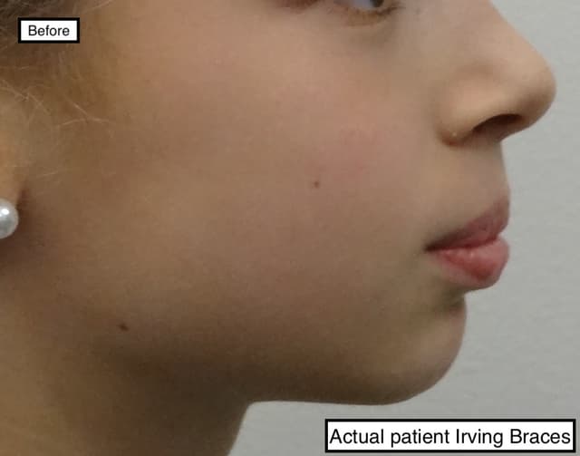 Irving Orthodontics photo