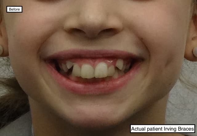 Irving Orthodontics photo