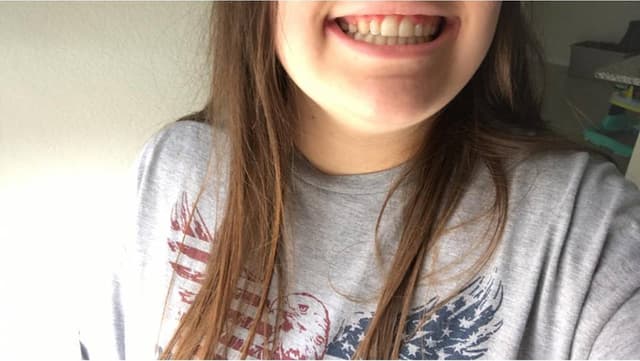 Prosper Trail Orthodontics photo