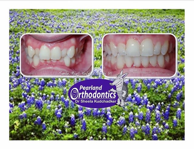 Pearland Orthodontics photo