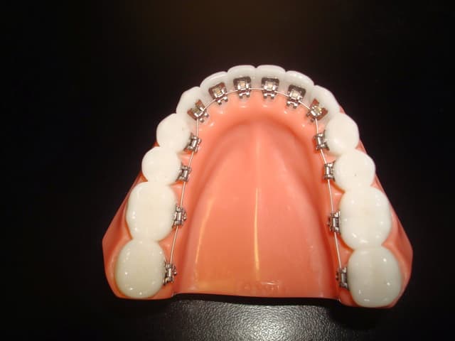 Leiker Orthodontics - Conroe photo