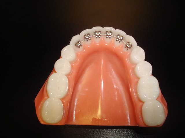 Leiker Orthodontics - Conroe photo