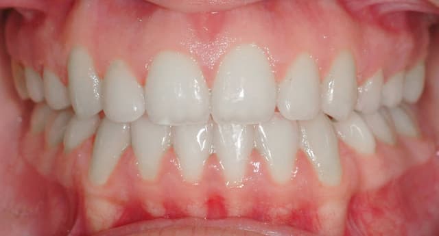 Leiker Orthodontics - Conroe photo