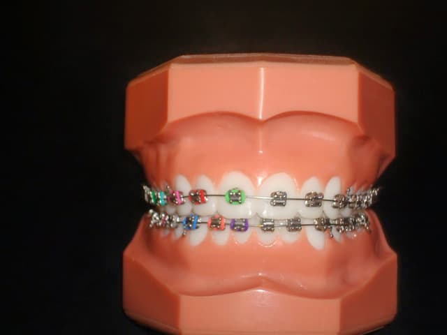 Leiker Orthodontics - Conroe photo