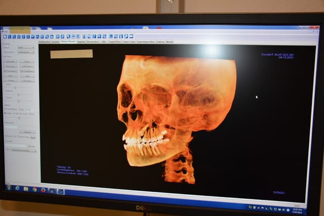 Shoff Orthodontics photo
