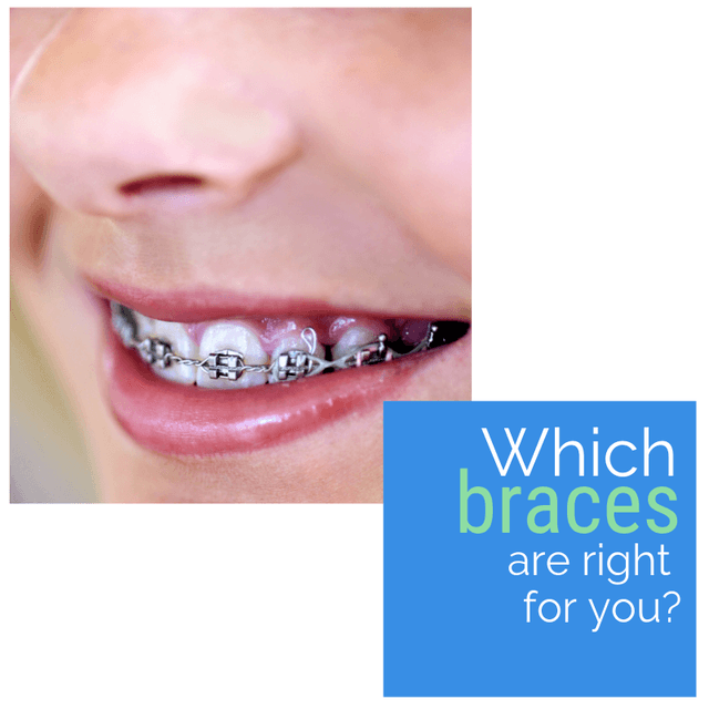 Shoff Orthodontics photo