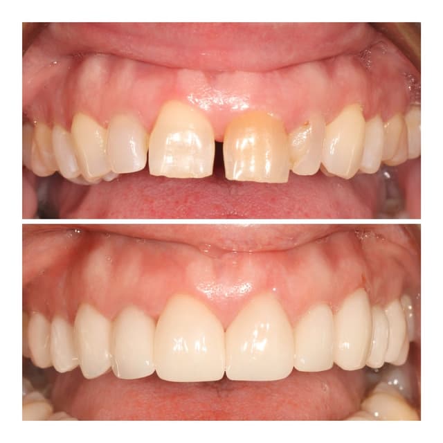 Sierra Smiles photo