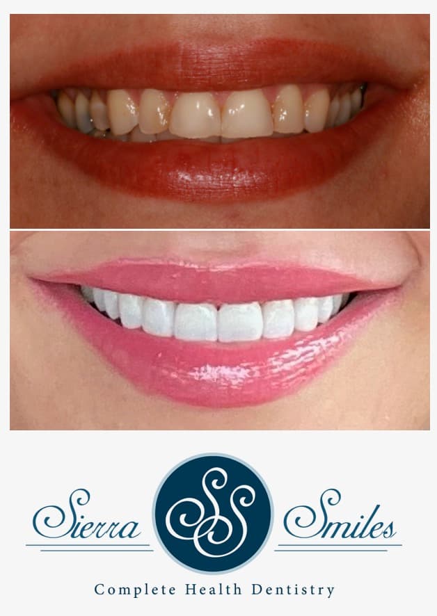 Sierra Smiles photo