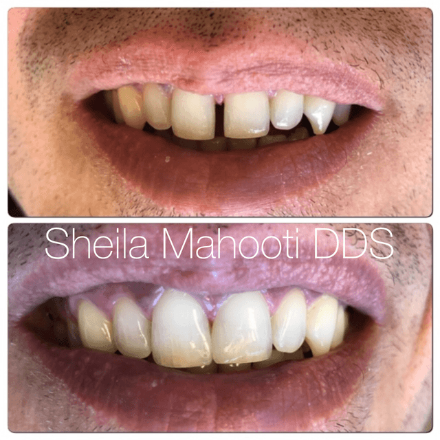 Signature Smiles of Encino photo
