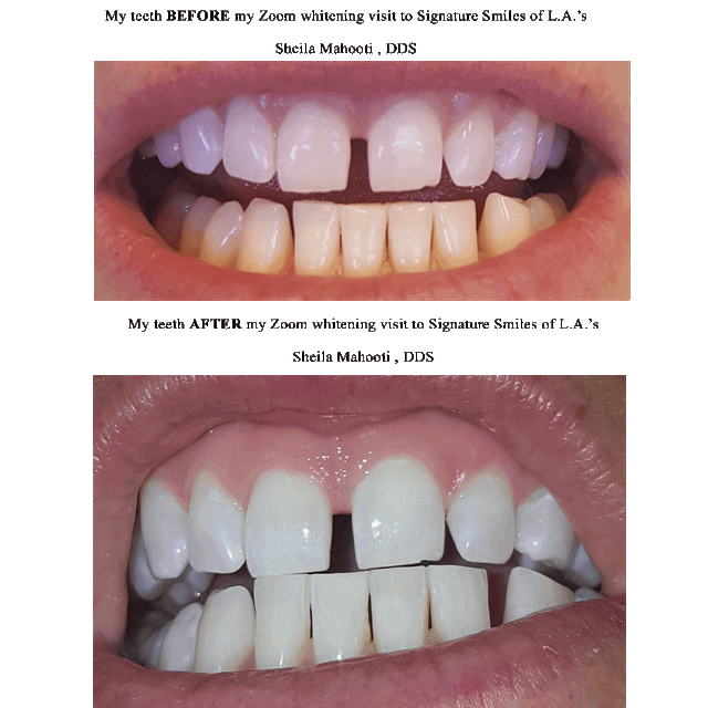 Signature Smiles of Encino photo