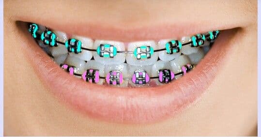Glenridge Orthodontics photo