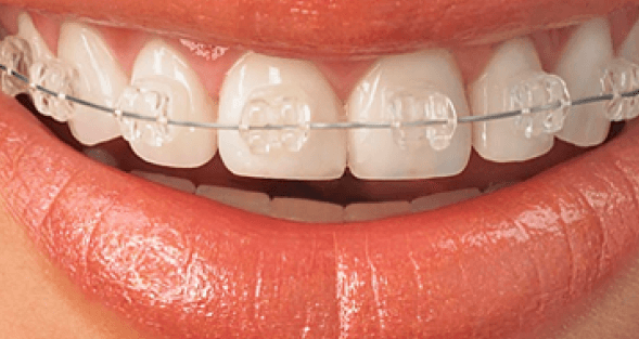 Glenridge Orthodontics photo