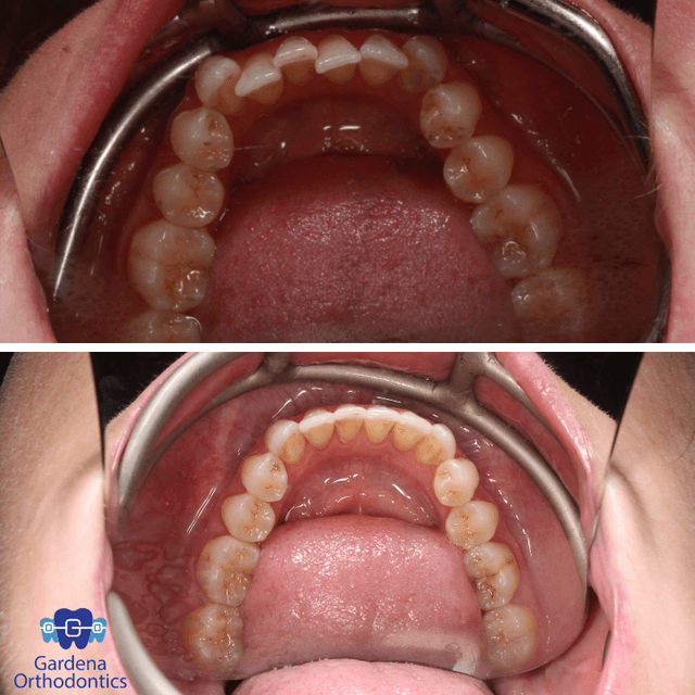 Gardena Orthodontics photo